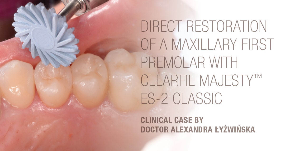 Clinical case with direct restoration of a maxillary first premolar