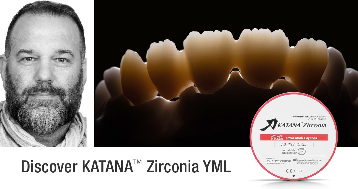 Cosmetic camouflage for a patient with periodontal disease