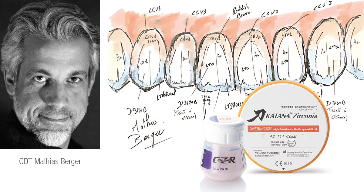 Efficient production of a zirconia overdenture