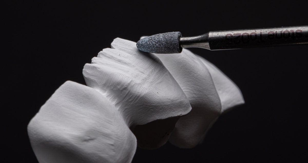 Transforming dentistry with groundbreaking technologies: Lifelike restorations with a micro-layer of porcelain