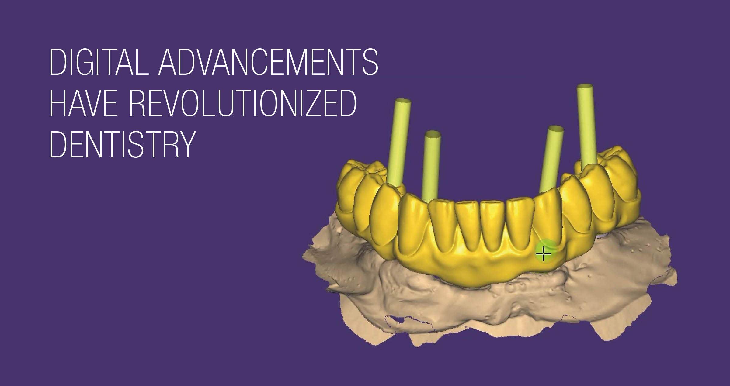 Comprehensive dental rehabilitation with digital workflow