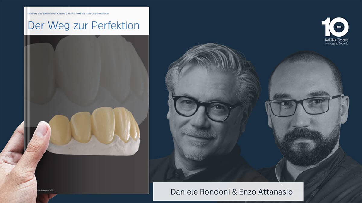 Der Weg zur Perfektion: Veneers aus Zirkonoxid 