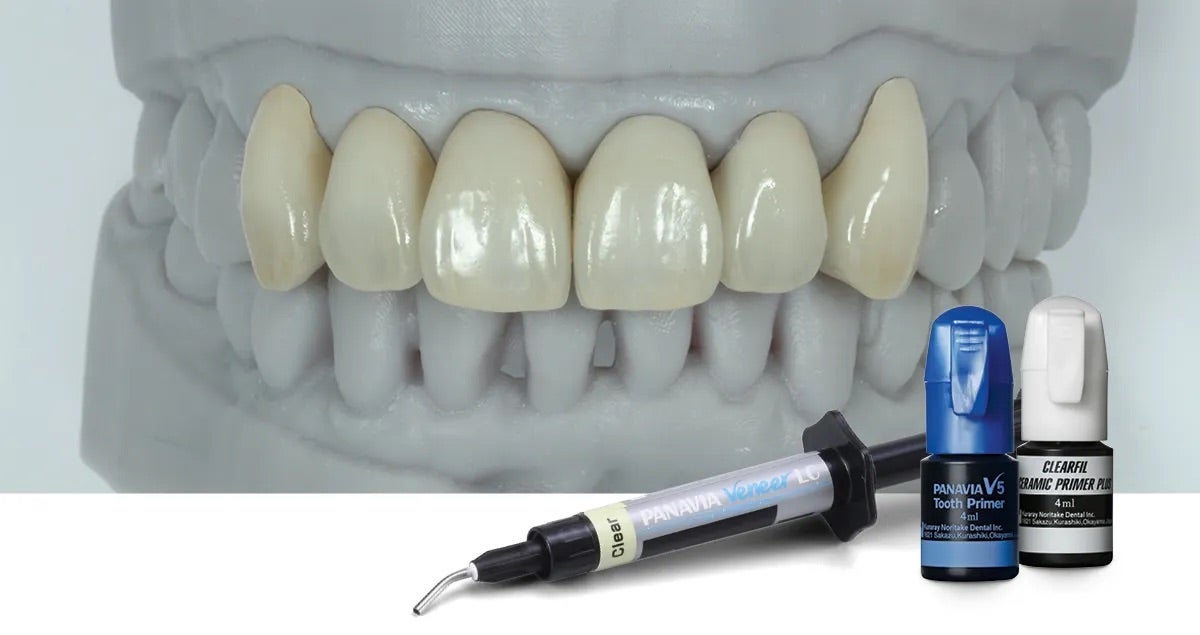 Veneer-Restauration aus KATANA™ Zirconia STML
