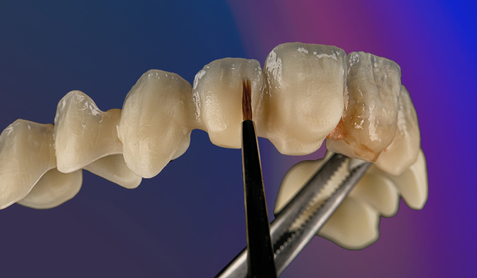 CERABIEN™ MiLai: Micro-Layering in seiner effizientesten Form