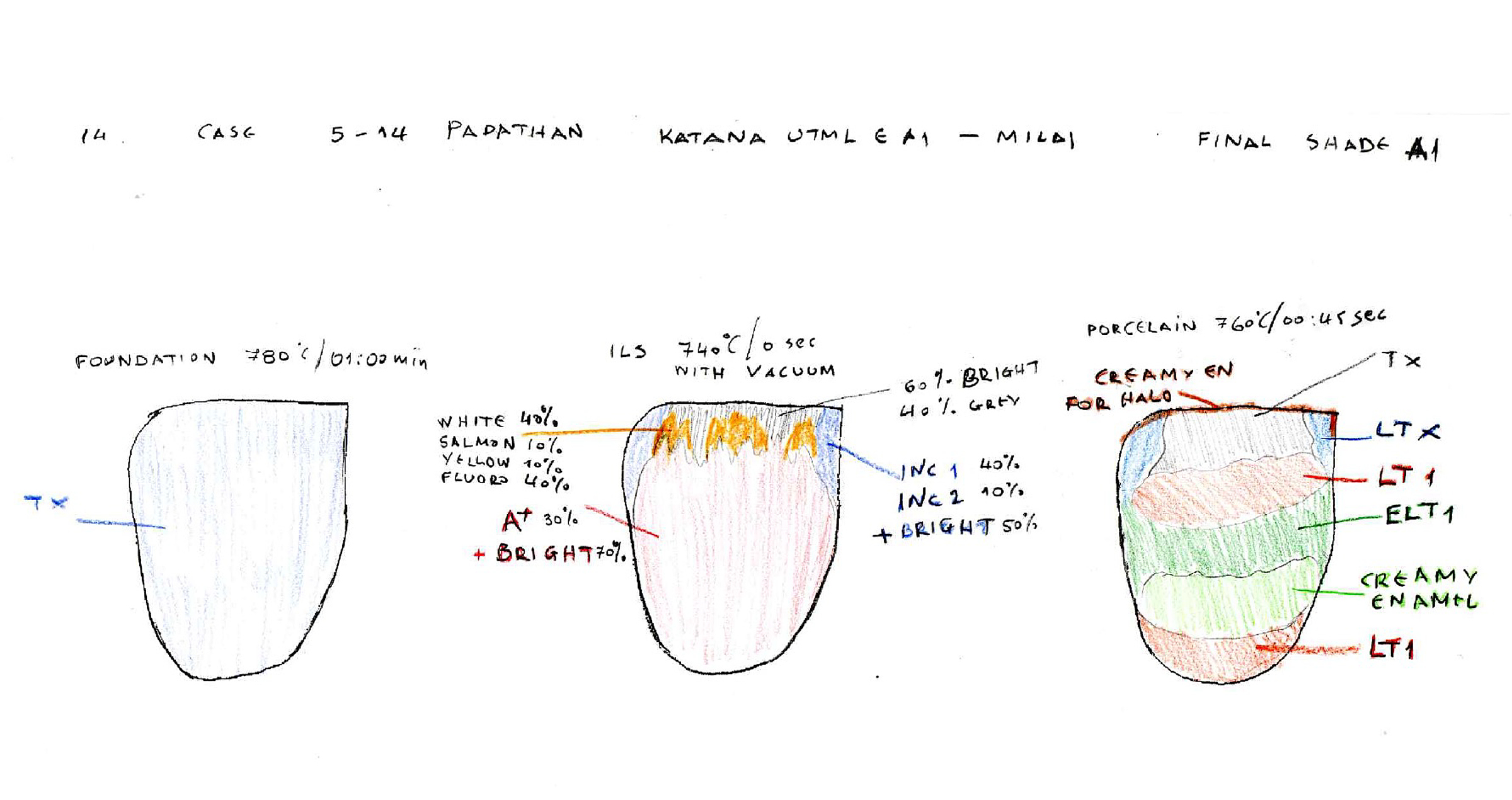 Biomimetics versus patient demands - finding the perfect balance