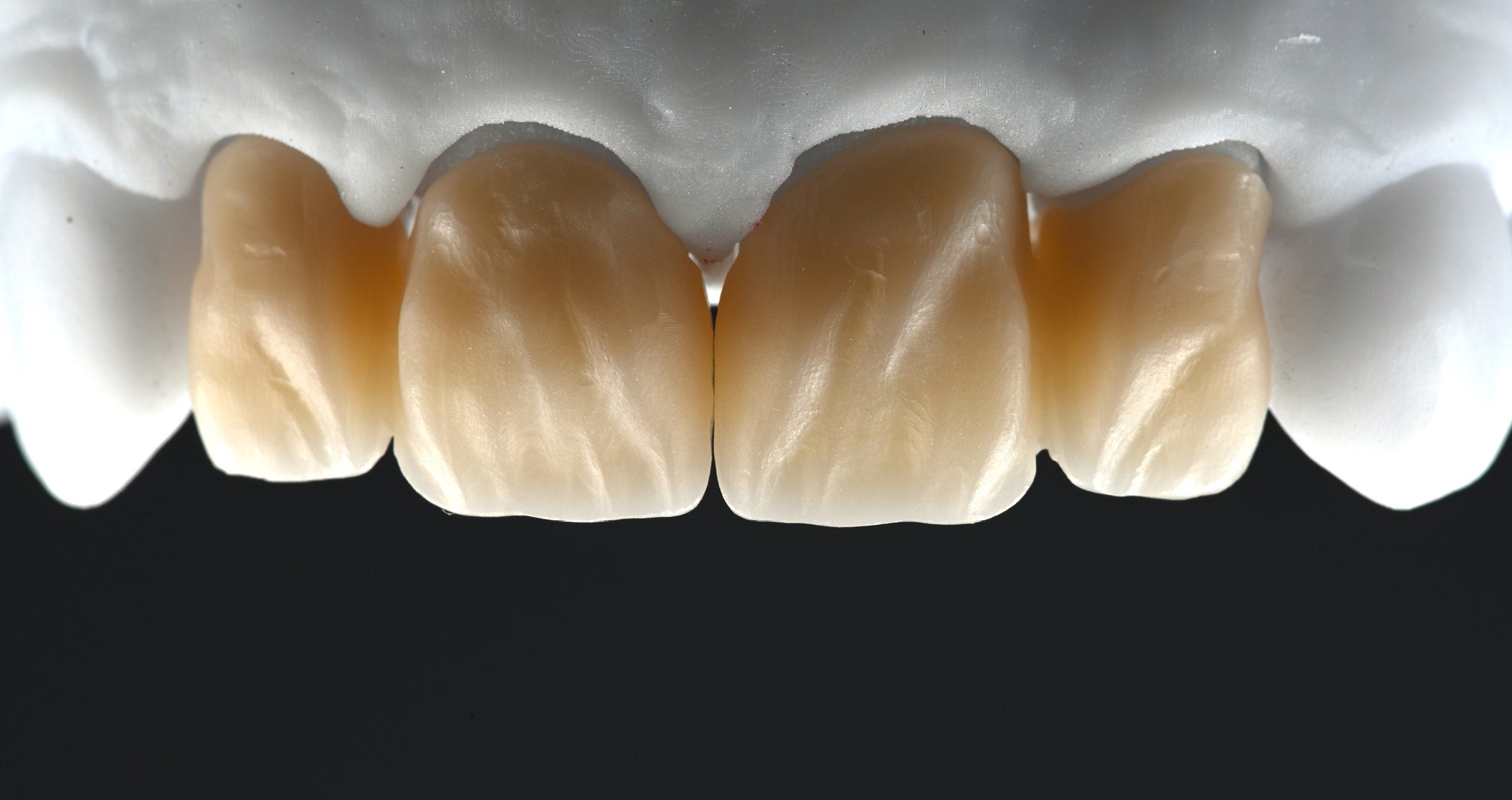 A smooth path towards beautiful smiles