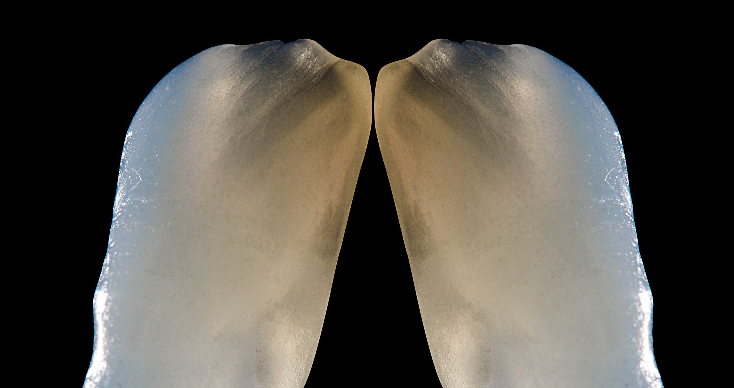 PURE Control: Value, Chroma and Shape in Ceramic Restorations