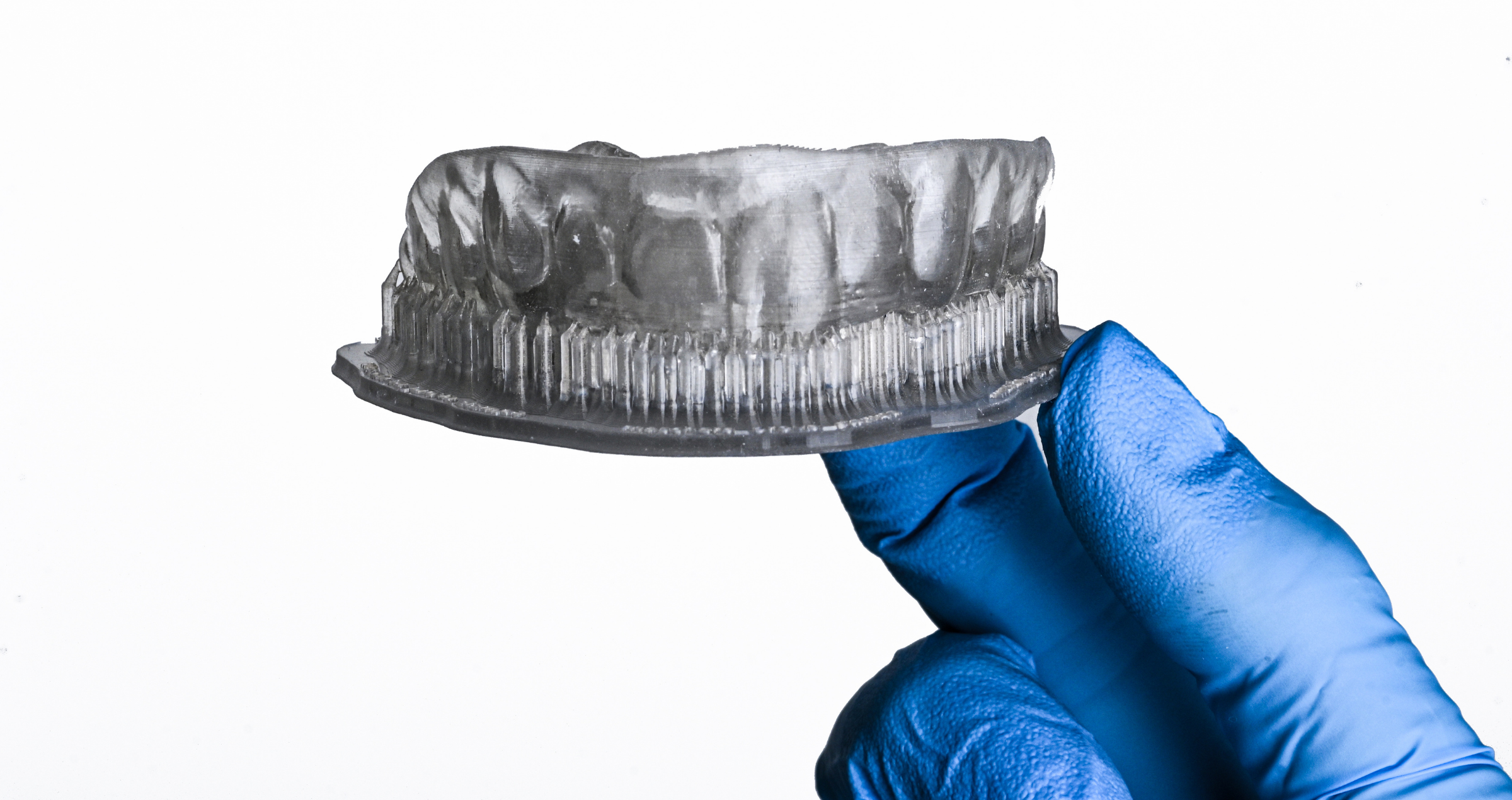 Minimally invasive dentistry and digital workflow: Clinical application of the Flowable Injection Technique