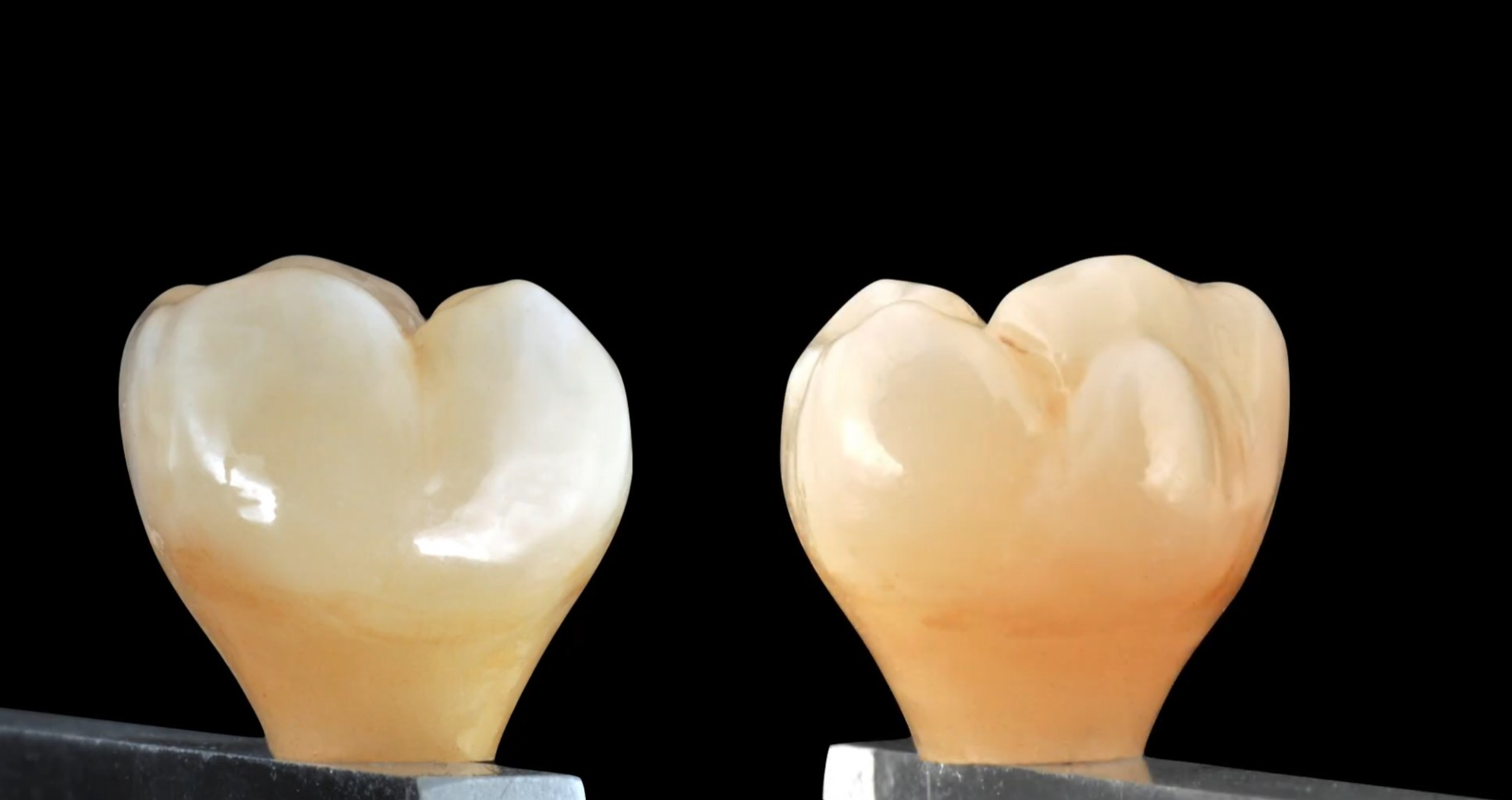 How to cement TiBase to zirconia crowns?