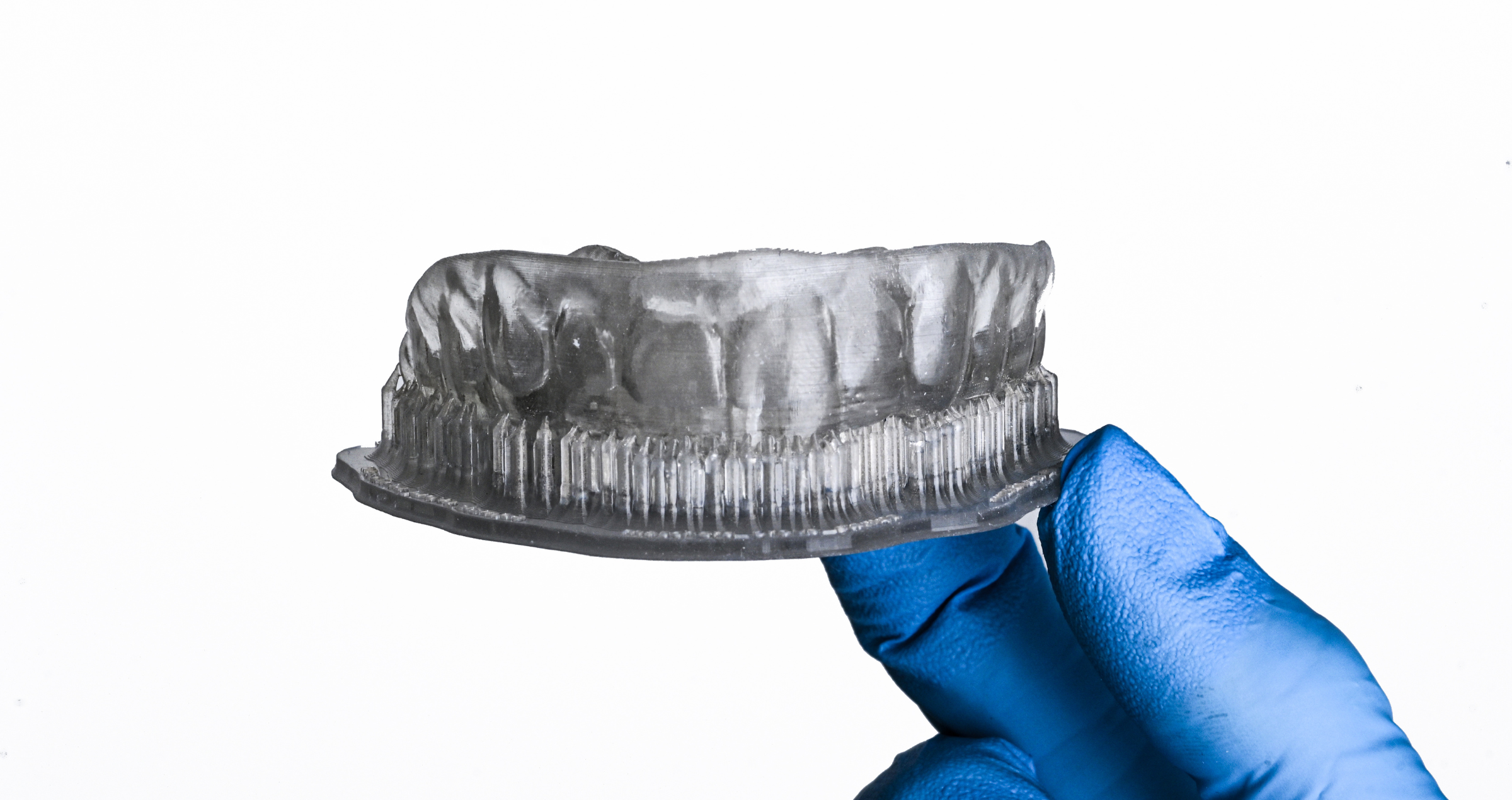 Odontoiatria minimamente invasiva e flusso digitale: applicazione clinica della Flow Injection Technique