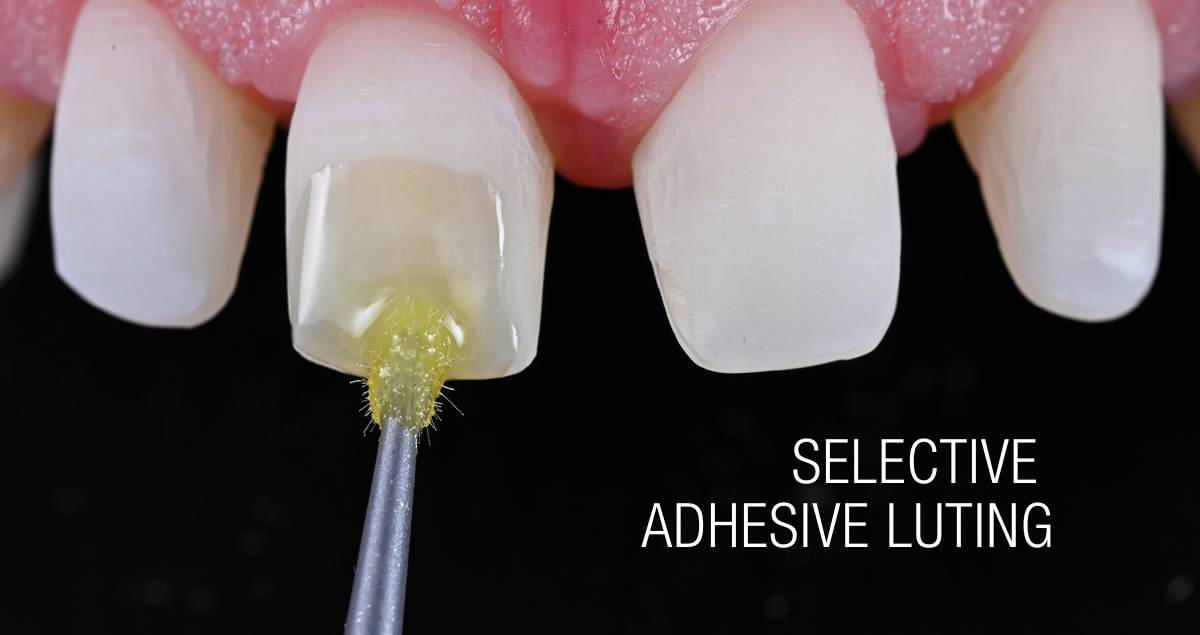 Cemento resina universale: hai mai pensato a una terza modalità di applicazione?