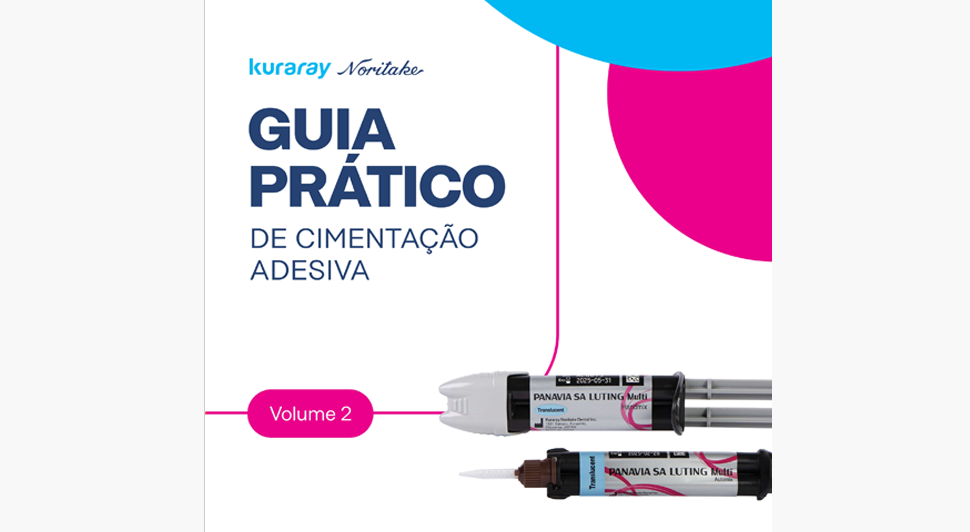 Guia Prático de Cimentação Adesiva – Volume 2