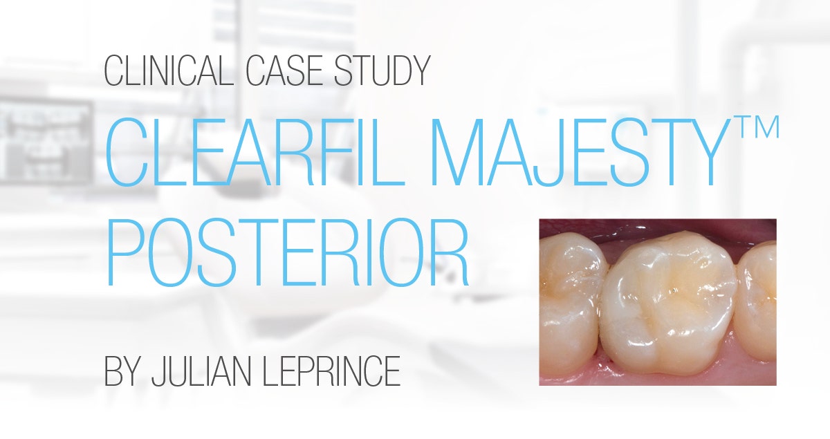 Clinical case with CLEARFIL MAJESTY™ Posterior