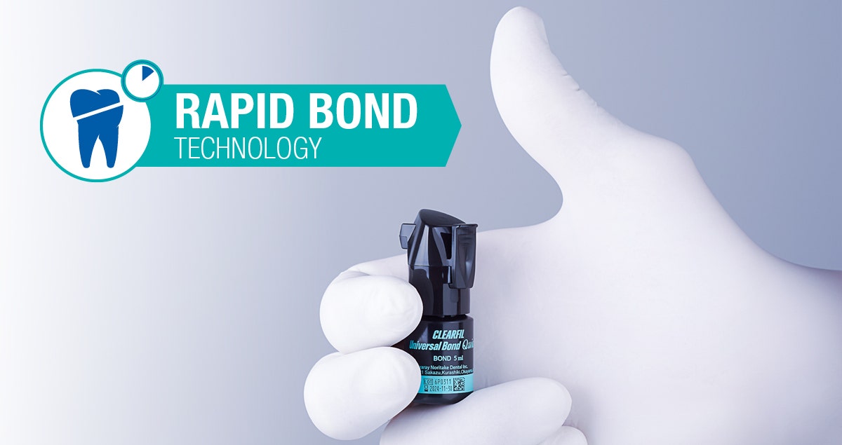 Rapid Bond Technology: aderência instantânea e duradoura