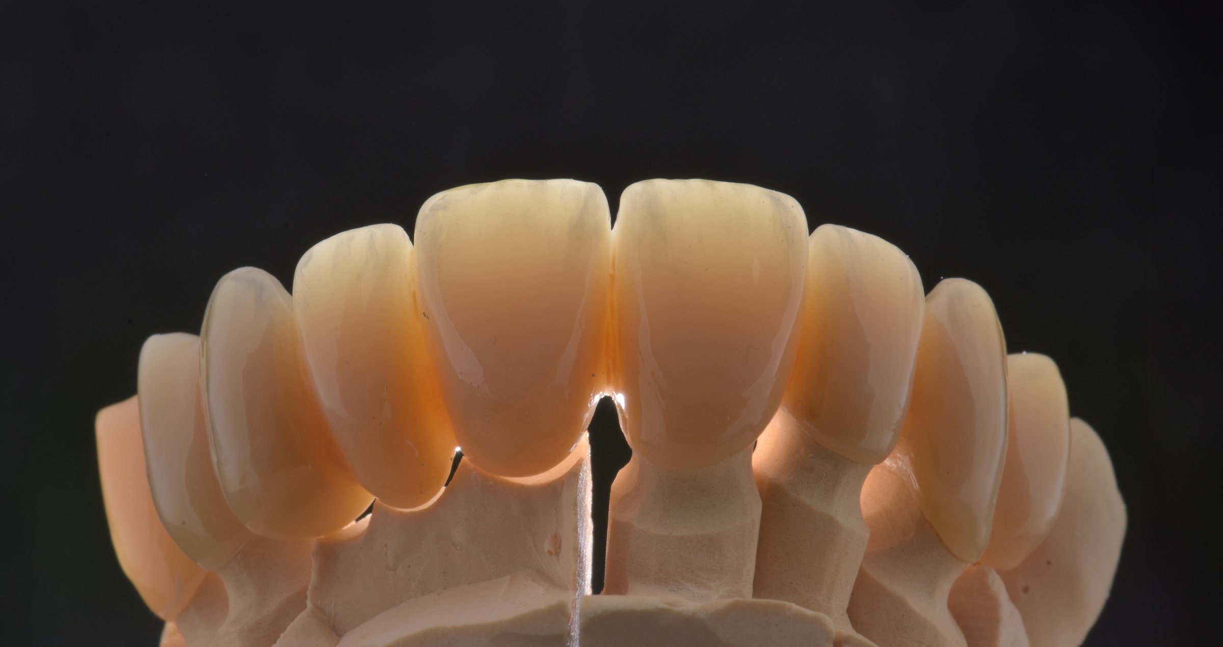 Quality and Inventory Management in the Dental Lab