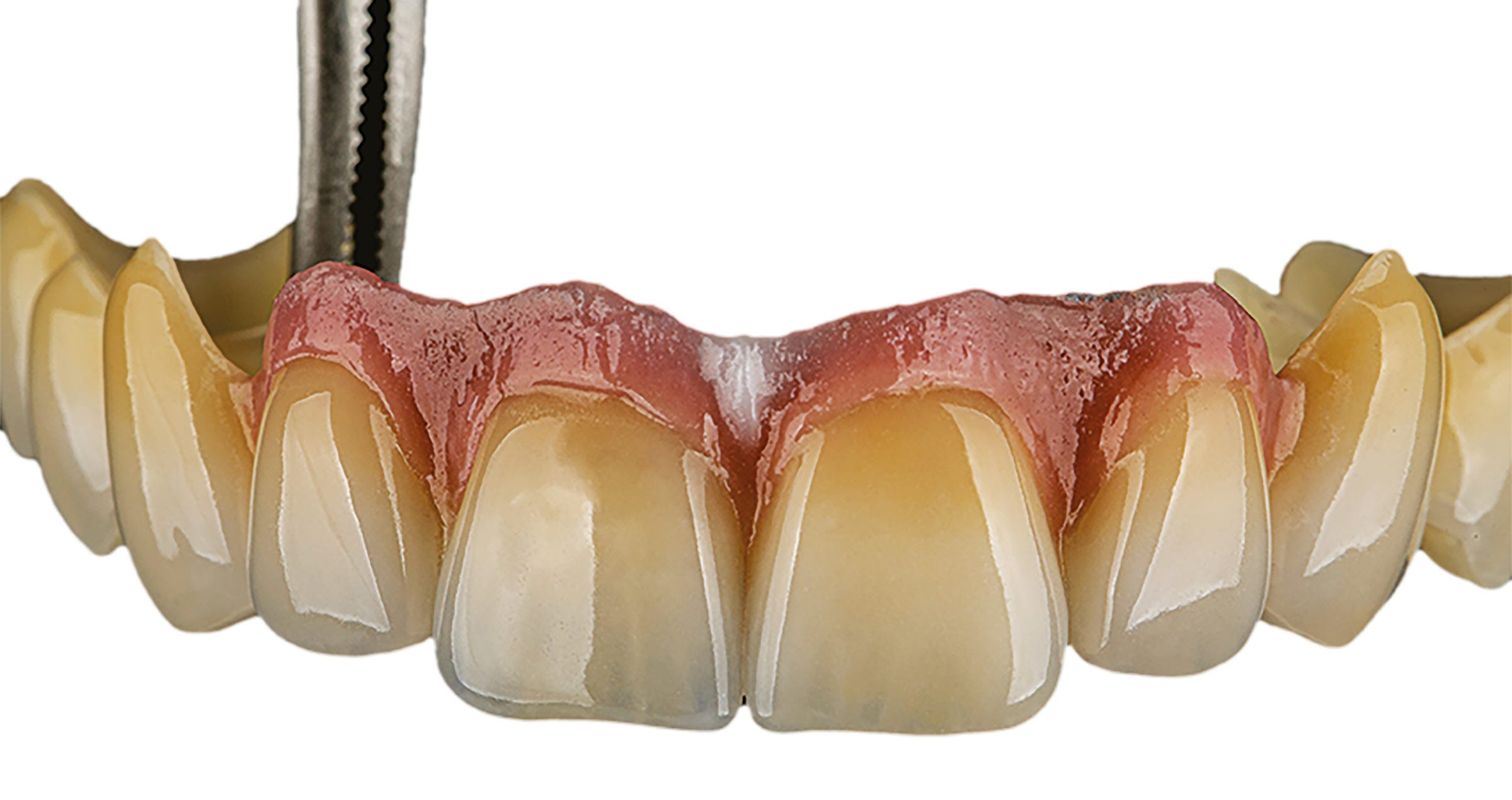 Welcome to the future of ceramic layering