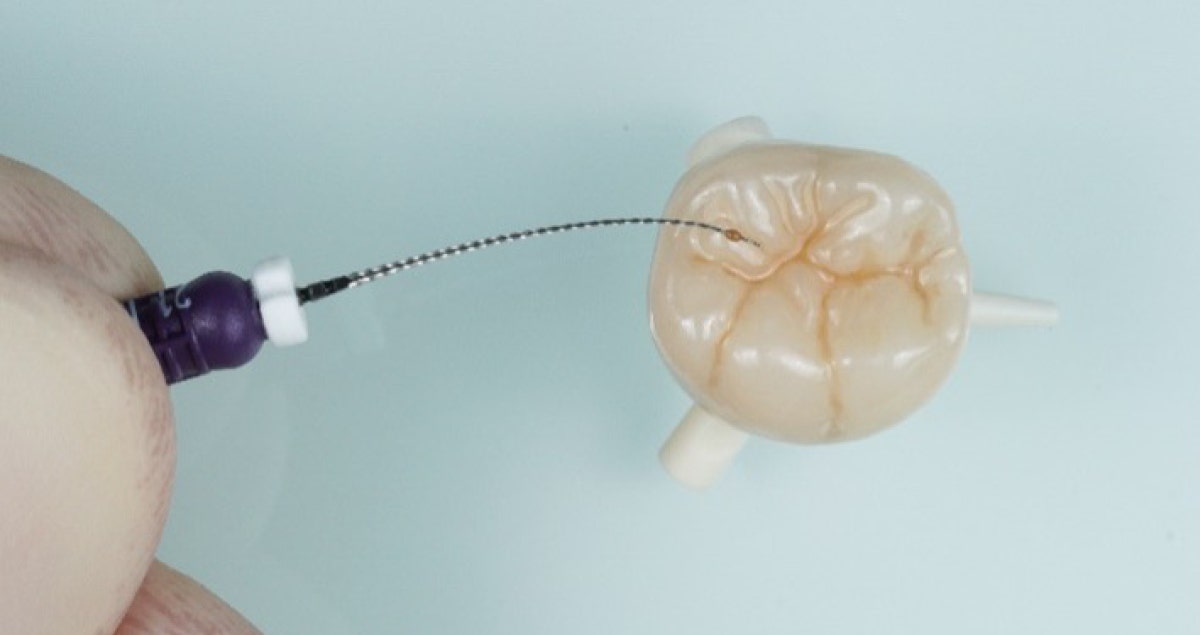 Individualisation of monolithic zirconia restorations