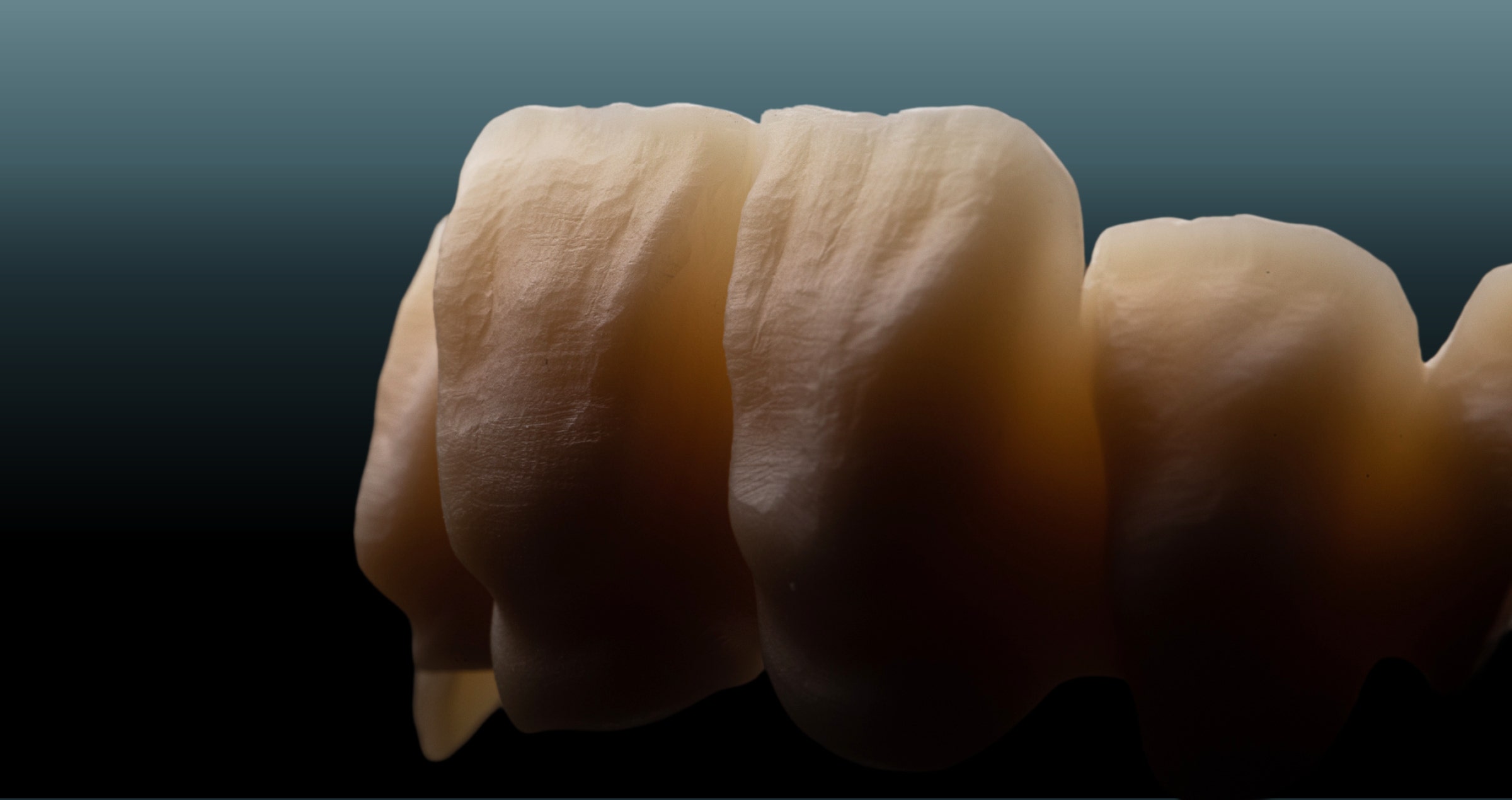 KATANA Zirconia Shade Selection Guidelines