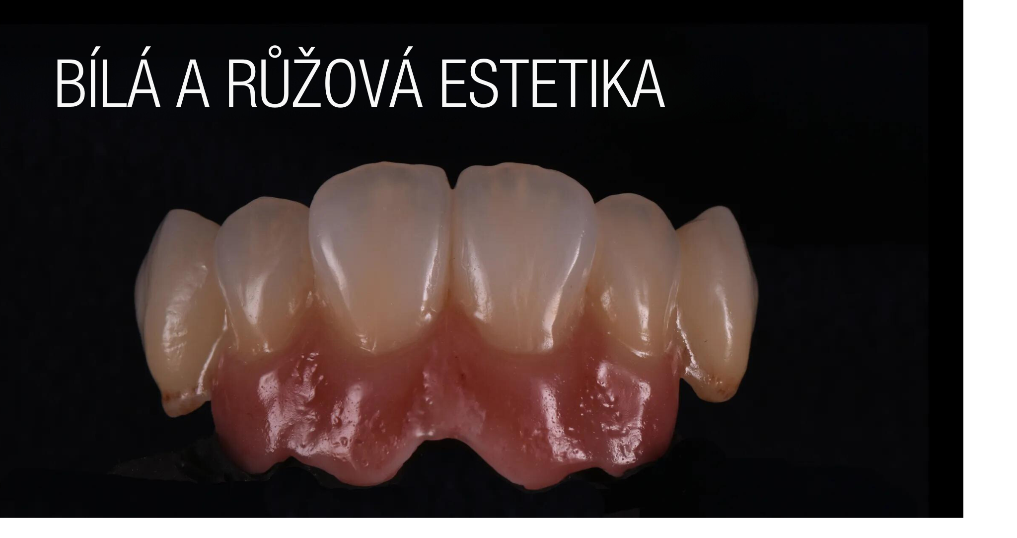 Dosažení maximální kvality v minimálním čase