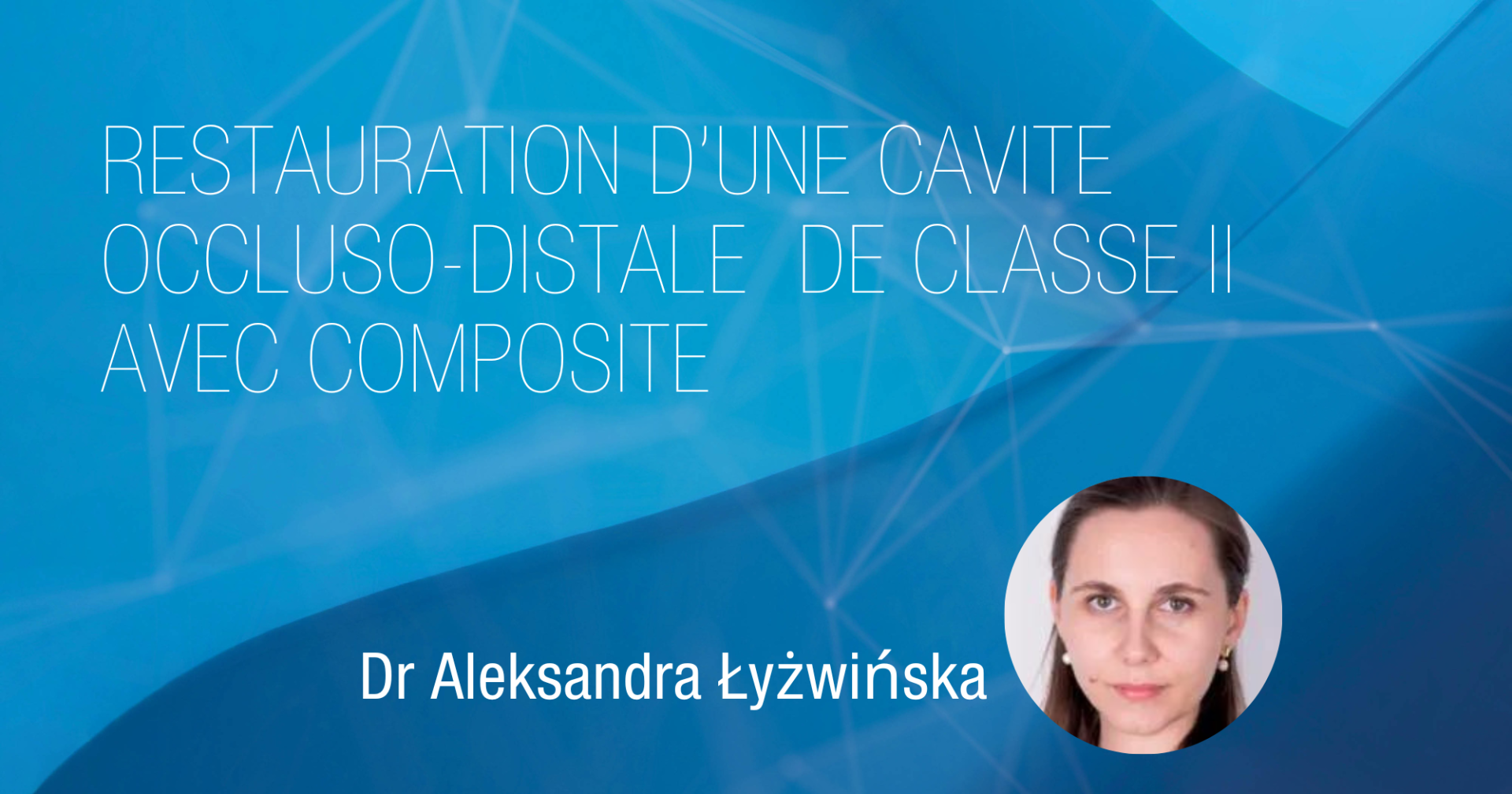Restauration d‘une cavité occluso-distale de classe II avec composite