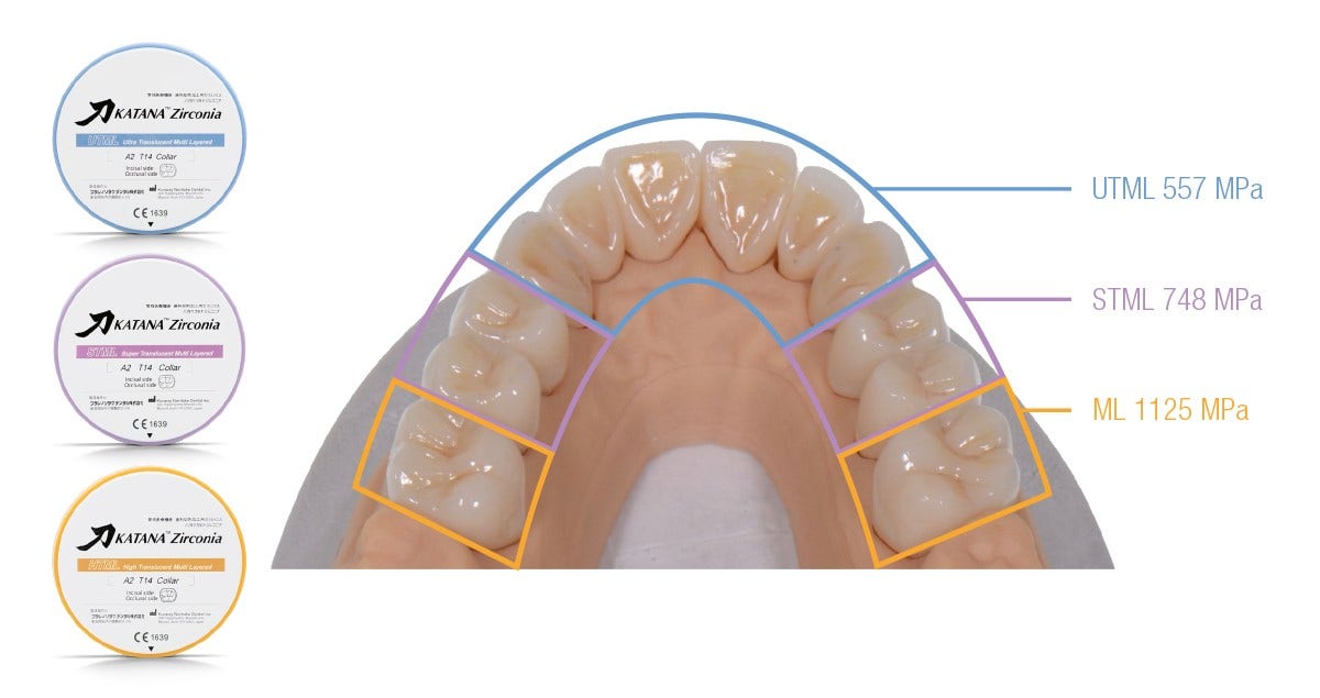 Clinical case: Full-mouth rehabilitation using multiple types of Zirconia