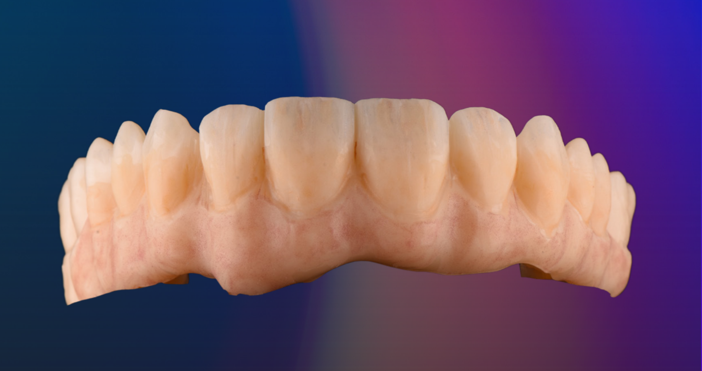 Powder ceramics redesigned for micro-layering
