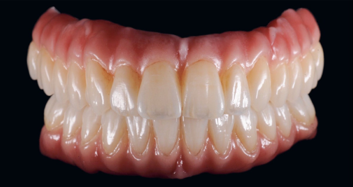 ZIRCONIA ON ZIRCONIA