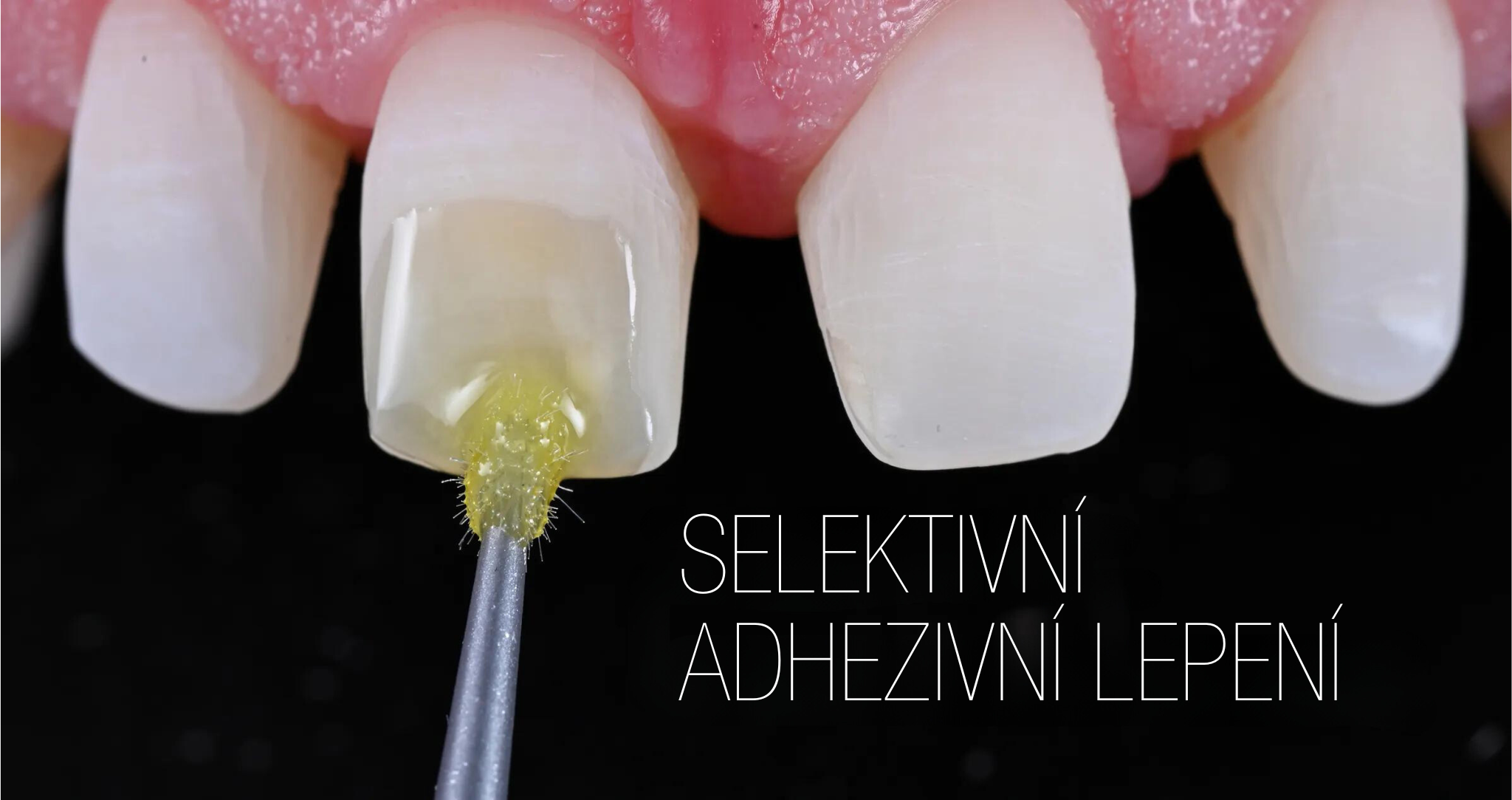 Univerzální pryskyřičný cement: přemýšleli jste někdy o třetím způsobu aplikace?