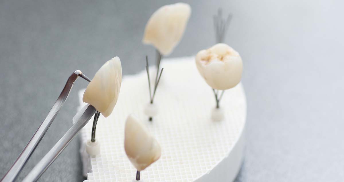 Using CERABIEN™ ZR FC Paste Stain with KATANA™ Zirconia