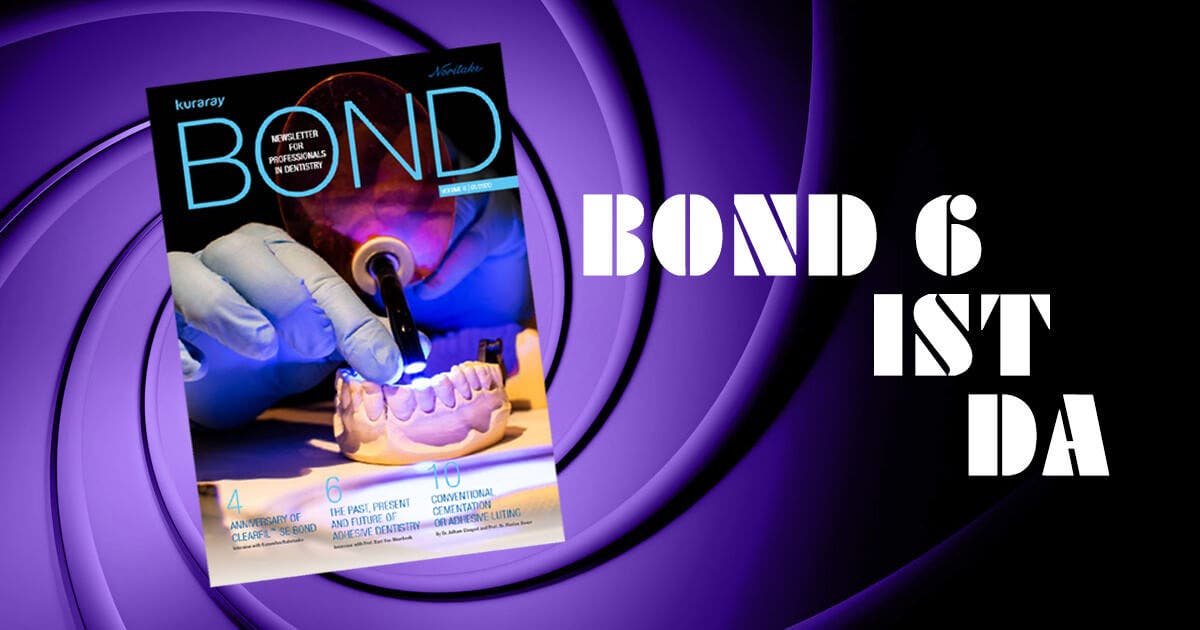 Bond 6 ist da!