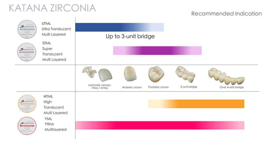 Abb. 4: Übersicht über das KATANA™ Zirconia Multi-Layered Materialportfolio und die empfohlenen Indikationen: KATANA™ Zirconia YML ist das einzige Material, welches das gesamte Indikationsspektrum abdeckt – von Einzelzahnrestaurationen bis hin zu langspannigen Brücken.