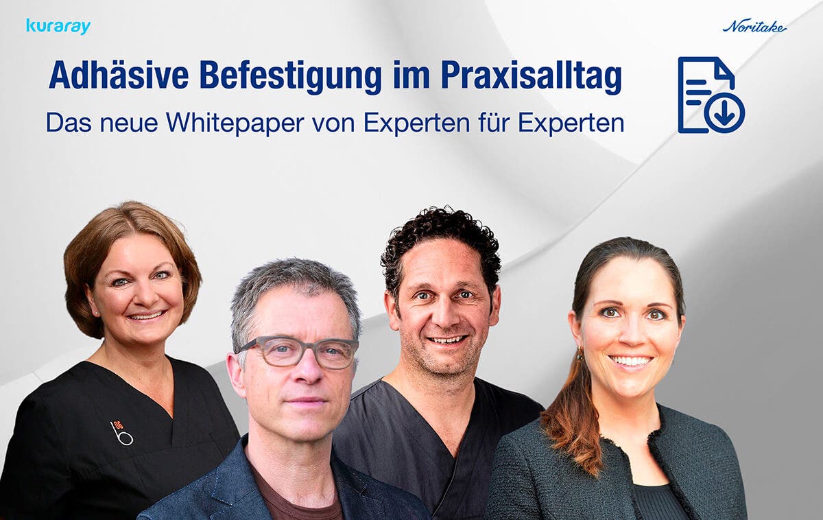 Whitepaper adhäsive Befestigung indirekter Restaurationen