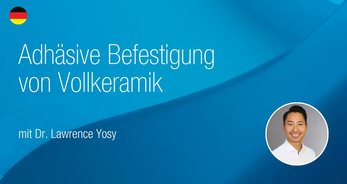 Aufzeichnung – Online-Seminar: Adhäsive Befestigung von Vollkeramik