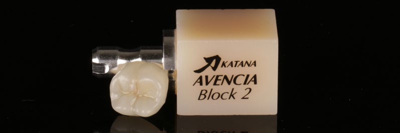 Abb. 6 CAD/CAM-gefertigtes Overlay aus KATANA™ AVENCIA™ Block 2 HT. Die anatomische Gestaltung unterstützt eine harmonische ästhetische Integration in die natürliche Zahnsubstanz.