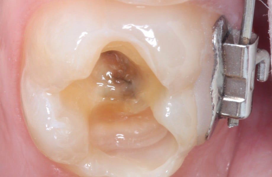 <p><strong>Image 2</strong> Préparation</p>