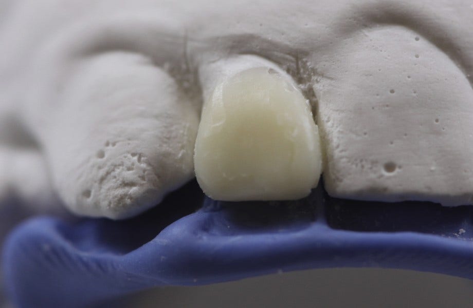 <p><strong>Image 2 </strong>Moule et clé en silicone</p>