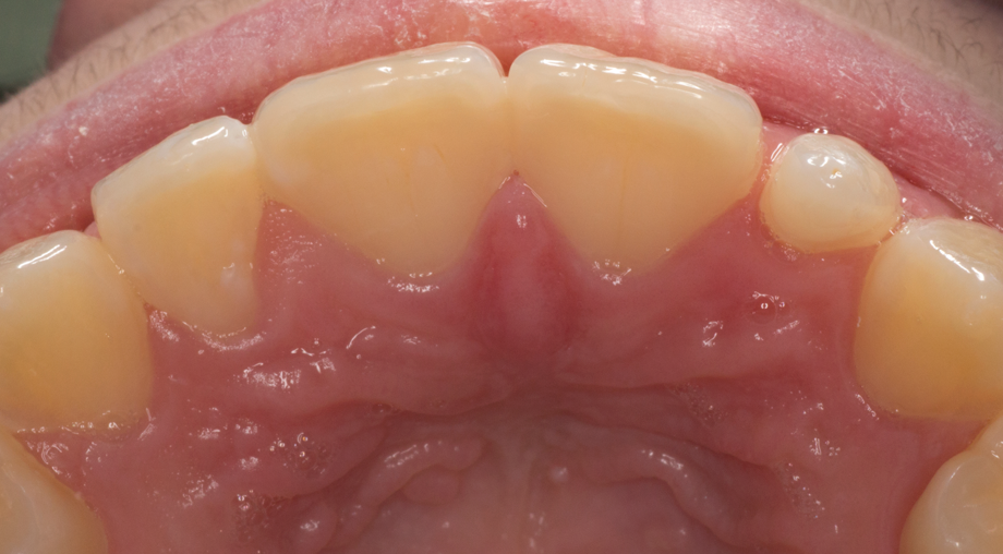 <p><span><strong>Image 2 </strong></span></p>