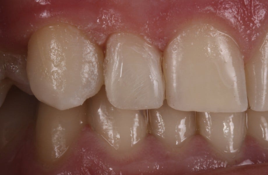 <p><strong>Image 7 </strong>Résultat final</p>