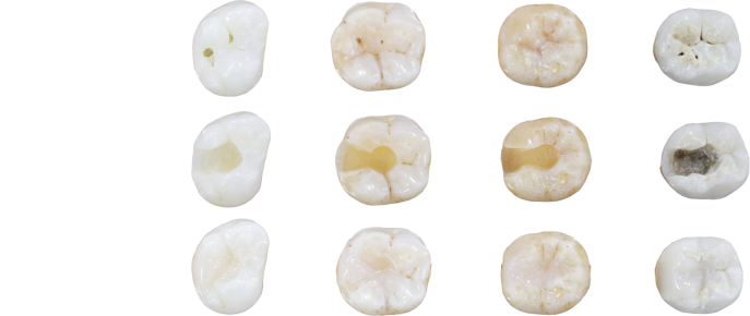 Tooth Image Desktop
