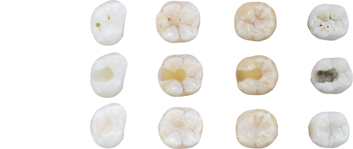 Tooth Image Desktop