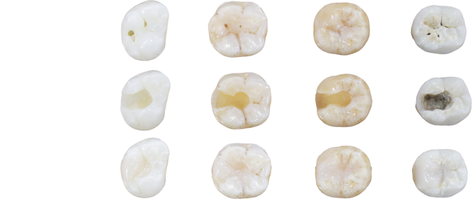 Tooth Image Desktop
