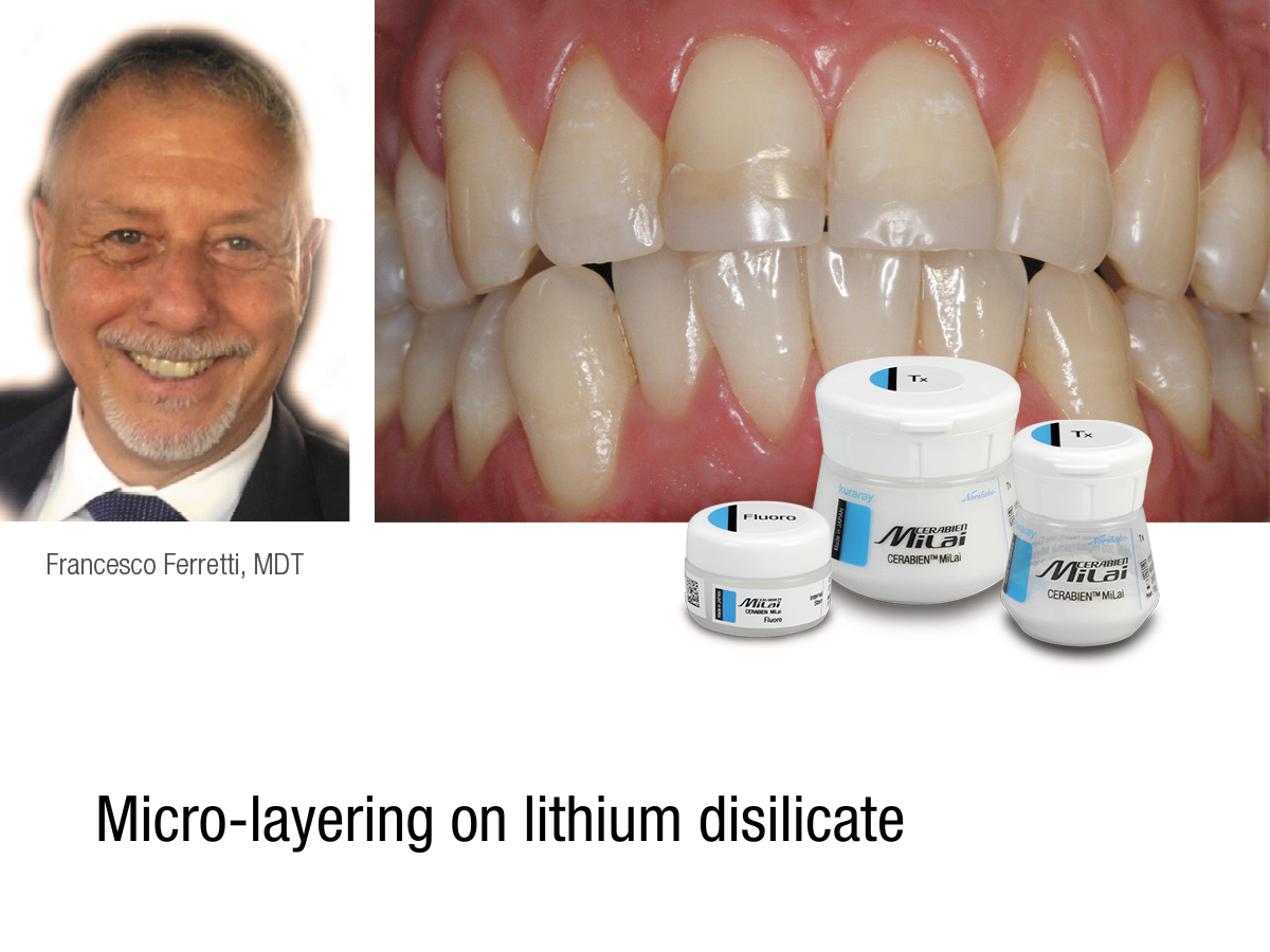 Micro-layering on lithium disilicate