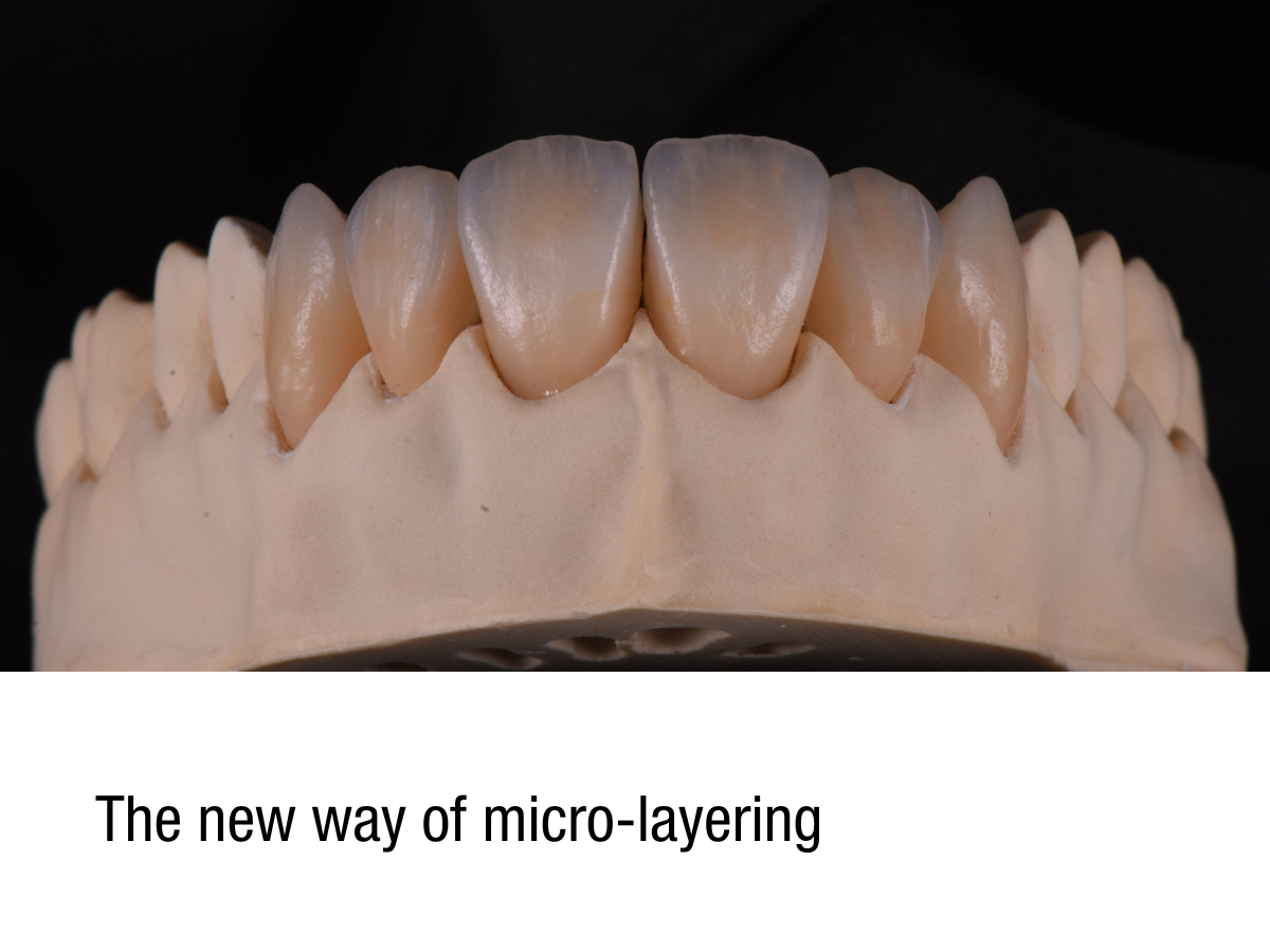 The new way of micro-layering