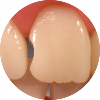 Rândul 1 fig. 3