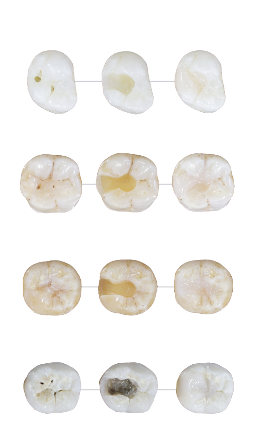 Imaginea dintelui Mobile