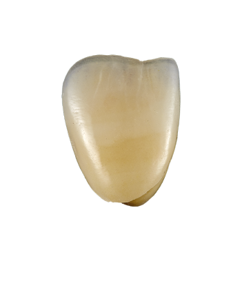 Tand image (počítač)