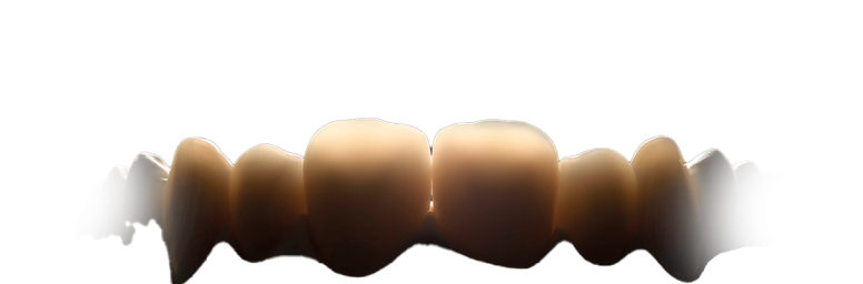 Vysoce estetický vzhled