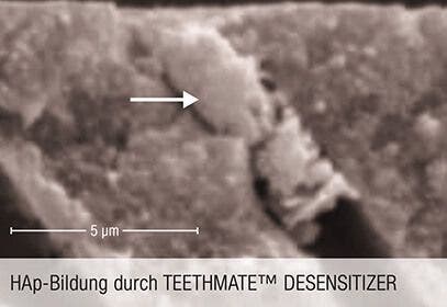 HAp-Bildung