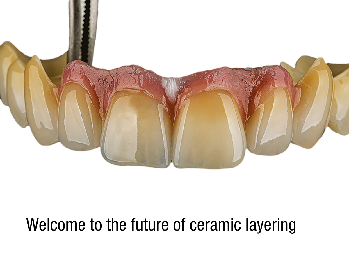 Welcome to the future of ceramic layering