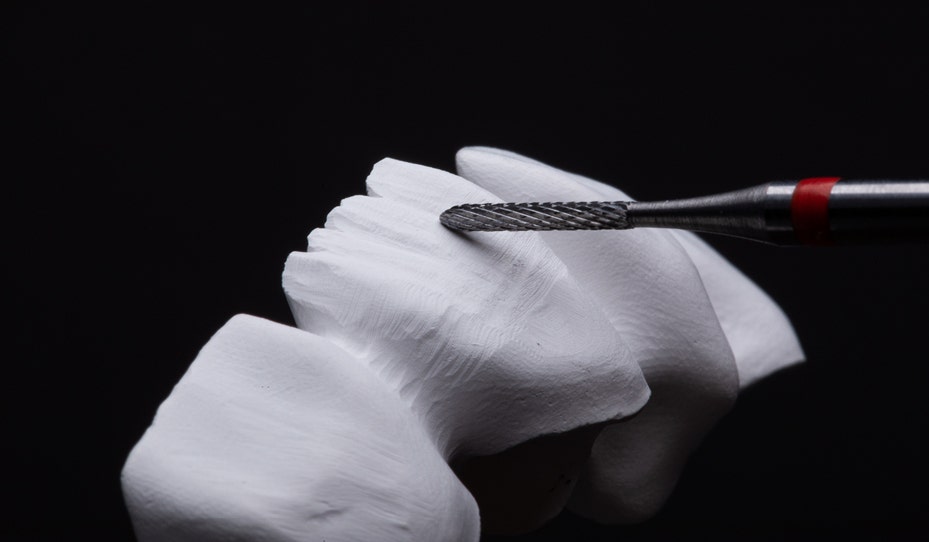  Transformer la dentisterie grâce à des technologies révolutionnaires : des restaurations plus vraies que nature avec une micro-couche de céramique